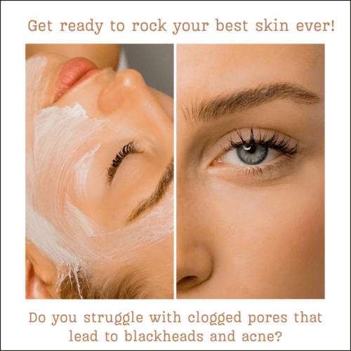 Get ready to rock your best skin